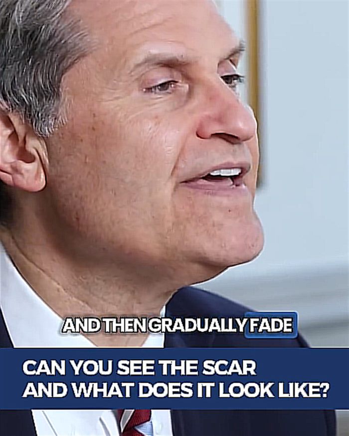 Can you see the scar and what does it look like