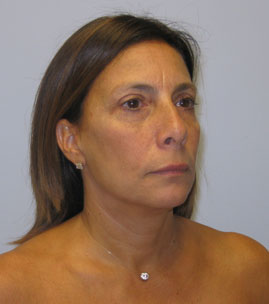 case08