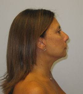 case08