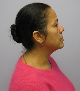 case09
