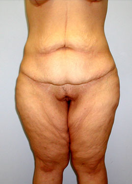 case01
