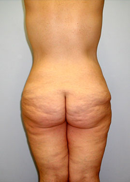 case01