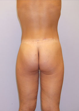 case01