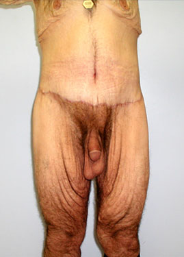 case02