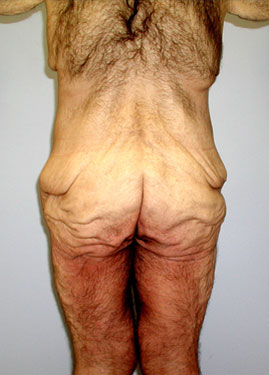 case02
