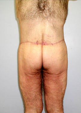case02