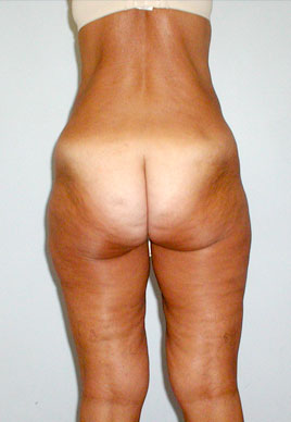 case03