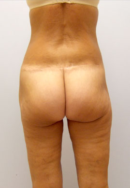 case03