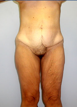 case04