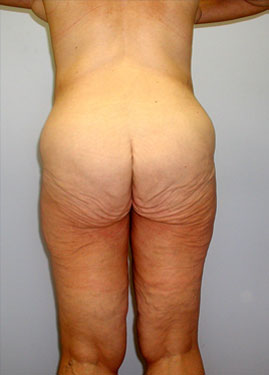 case04