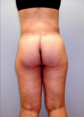 case04