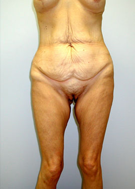 case05