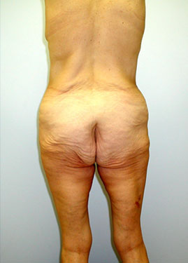 case05