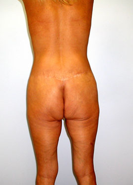 case05