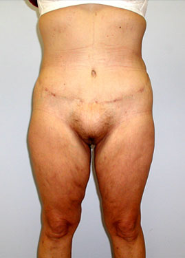 case06