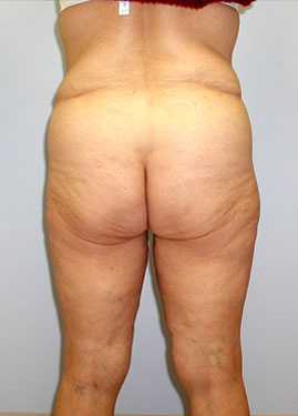 case06