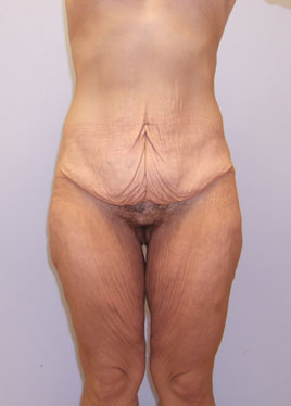 case07
