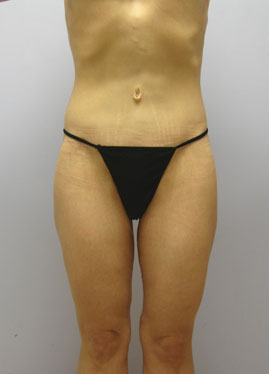 case07