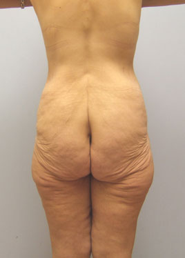 case07