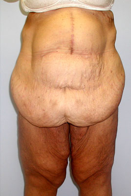 case08