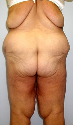 case08