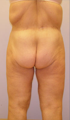 case08