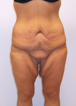 case09