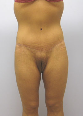 case09