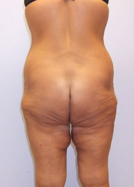 case09