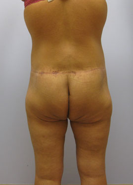 case09
