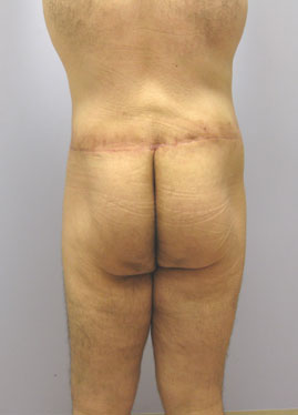 case11