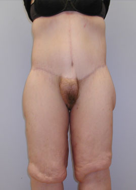 case14