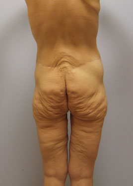 case20