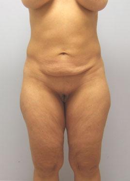 case21