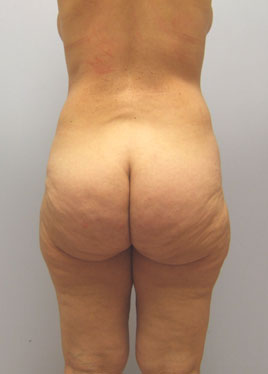 case21