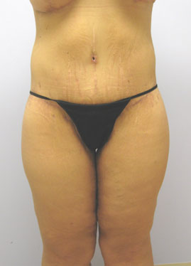 case23