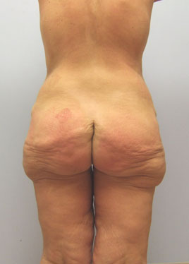 case23