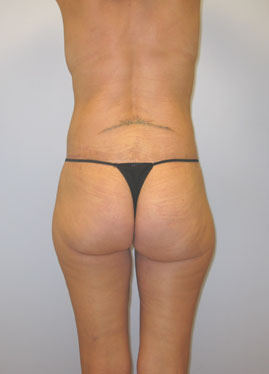 case24