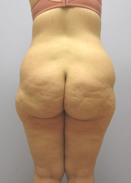case25