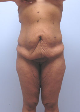 case26