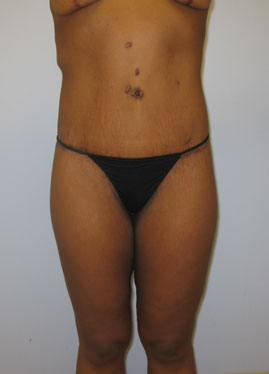 case26