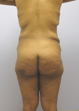 case26