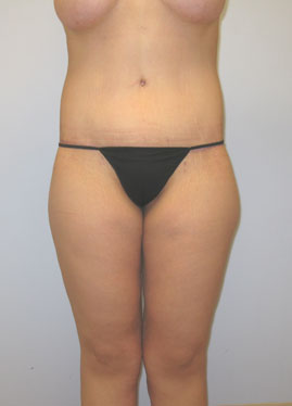 case27