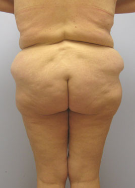 case29
