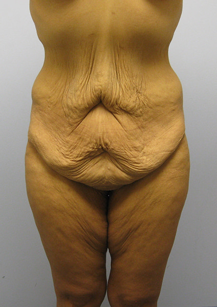 case45