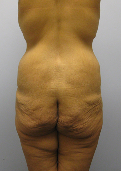 case45